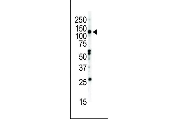 EPH Receptor B2 antibody  (C-Term)