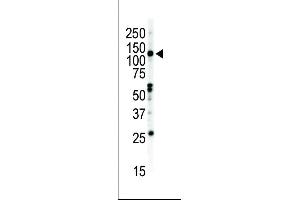 Western blot analysis of anti-EphB2 C-term Pab (ABIN391920 and ABIN2841730) in NCI- cell lysate. (EPH Receptor B2 antibody  (C-Term))