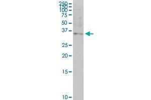 OTP monoclonal antibody (M03), clone 8E12. (OTP antibody  (AA 11-120))
