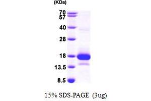 SDS-PAGE (SDS) image for Methylmalonyl CoA Epimerase (MCEE) (AA 37-176) protein (His tag) (ABIN667242) (MCEE Protein (AA 37-176) (His tag))