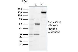 SDS-PAGE Analysis Purified CD284 Mouse Monoclonal Antibody (TLR4/230). (TLR4 antibody)