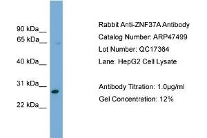 WB Suggested Anti-ZNF37A  Antibody Titration: 0.