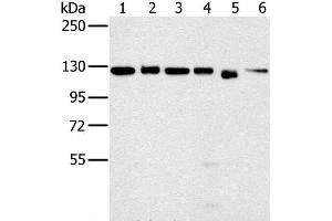 Western Blot analysis of 293T, K562, hela, 231, Jurkat and NIH/3T3 cell using MATR3 Polyclonal Antibody at dilution of 1:500 (MATR3 antibody)