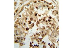 Immunohistochemistry analysis in formalin-fixed and paraffin-embedded human testis tissue reacted with 17-beta-HSD3 / HSD17B3 Antibody (Center) followed which was peroxidase conjugated to the secondary antibody, followed by DAB staining. (HSD17B3 antibody  (Middle Region))