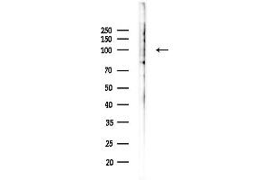 Western blot analysis of lysates from HepG2 cells(LPS,4h treatment), using TM16G Antibody at 1/1000 dilution.