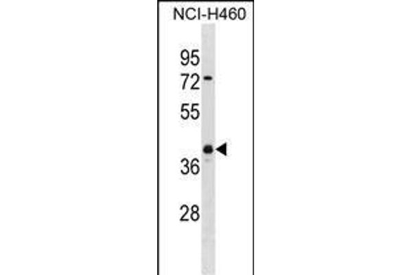 UCHL5 antibody  (AA 136-164)