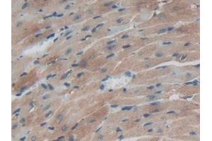IHC-P analysis of Mouse Heart Tissue, with DAB staining. (TXNRD1 antibody  (AA 374-577))