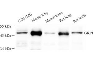 Western blot analysis of GRP1 (ABIN7073681) at dilution of 1: 250 (Cytohesin 3 antibody)