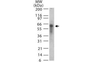 Western blot analysis of ASB3 in 15 ugs of human spleen lysate. (ASB3 antibody  (AA 63-75))