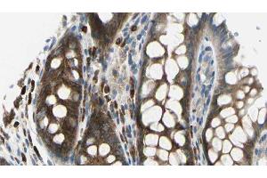 ABIN6278288 at 1/100 staining Rat colon tissue by IHC-P. (TMOD2 antibody  (N-Term))