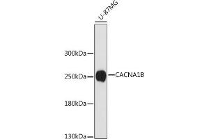 Western blot analysis of extracts of U-87MG cells, using CB antibody (ABIN7266014) at 1:1000 dilution.