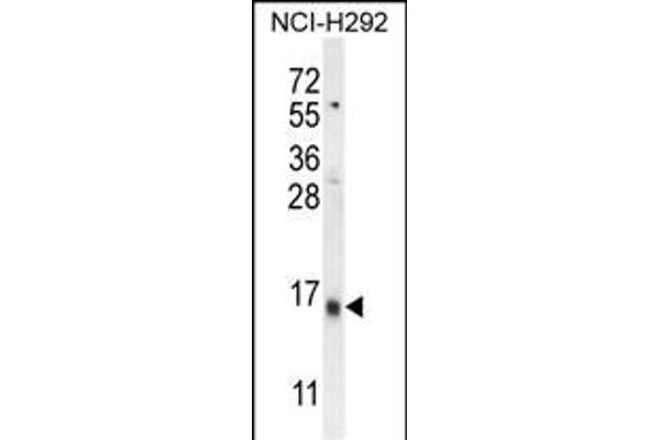 LY6G6C antibody  (C-Term)