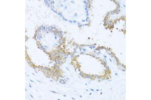 Immunohistochemistry of paraffin-embedded human breast using N antibody (ABIN6132387, ABIN6144378, ABIN6144379 and ABIN6216511) at dilution of 1:100 (40x lens). (NAT2 antibody  (AA 171-290))