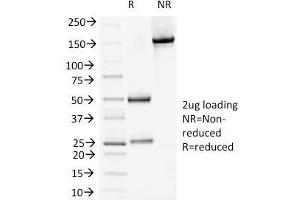 SDS-PAGE Analysis Purified DSG1 Mouse Monoclonal Antibody (18D4).