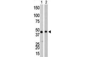 Western Blotting (WB) image for anti-Creatine Kinase, Brain (CKB) antibody (ABIN3002966) (CKB antibody)