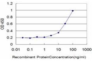 Detection limit for recombinant GST tagged DAAM1 is approximately 1ng/ml as a capture antibody. (DAAM1 antibody  (AA 1-110))