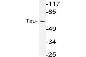 Western blot (WB) analysis of Tau antibody in extracts from rat brain cells. (MAPT antibody)
