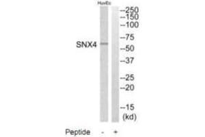 Western blot analysis of extracts from HuvEc cells, using SNX4 antibody. (Sorting Nexin 4 antibody)