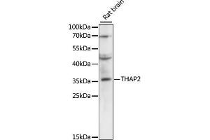 Western blot analysis of extracts of rat brain, using TH antibody (ABIN6133215, ABIN6149107, ABIN6149108 and ABIN6220276) at 1:3000 dilution.