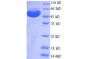 SDS-PAGE (SDS) image for Protein Arginine Methyltransferase 1 (PRMT1) (AA 1-248), (partial) protein (GST tag) (ABIN4976330) (PRMT1 Protein (AA 1-248, partial) (GST tag))