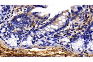Detection of PINP in Rat Colon Tissue using Polyclonal Antibody to Procollagen I N-Terminal Propeptide (PINP) (PINP antibody  (AA 23-151))