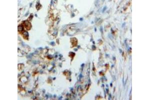 #VALUE! (Surfactant Protein C antibody  (AA 24-197))