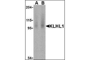 Western blot analysis of KLHL1 in human brain cell lysate with this product at (A) 2 and (B) 4 μg /ml. (KLHL1 antibody  (N-Term))