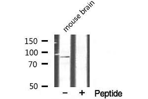 Western blot analysis of extracts from mouse brain, using CHSY1 antibody. (CHSY1 antibody  (Internal Region))