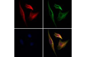 ABIN7094143 and ABIN7098187 staining Hela cells by IF/ICC.
