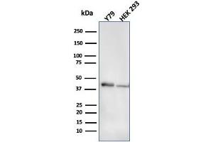Western Blot Analysis of Y79 and HEK293 cell lysate using CKBB Mouse Monoclonal Antibody (CPTC-CKB-2). (CKB antibody)