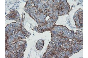 Image no. 2 for anti-Zinc Finger Protein 365 (ZNF365) (AA 108-407) antibody (ABIN1490828) (ZNF365 antibody  (AA 108-407))