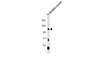 Anti-LGR5 Antibody (loop2) at 1:1000 dilution + Human skeletal muscle tissue lysate Lysates/proteins at 20 μg per lane. (LGR5 antibody  (AA 689-719))