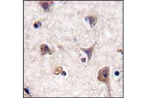 Immunohistochemistry (Paraffin-embedded Sections) (IHC (p)) image for anti-Microtubule-Associated Protein 1 Light Chain 3 alpha (MAP1LC3A) (AA 1-30), (N-Term) antibody (ABIN1449594)