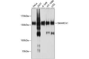 Western blot analysis of extracts of various cell lines, using SM antibody (ABIN6132562, ABIN6148098, ABIN6148099 and ABIN6214424) at 1:1000 dilution. (SMARCA1 antibody  (AA 1-200))