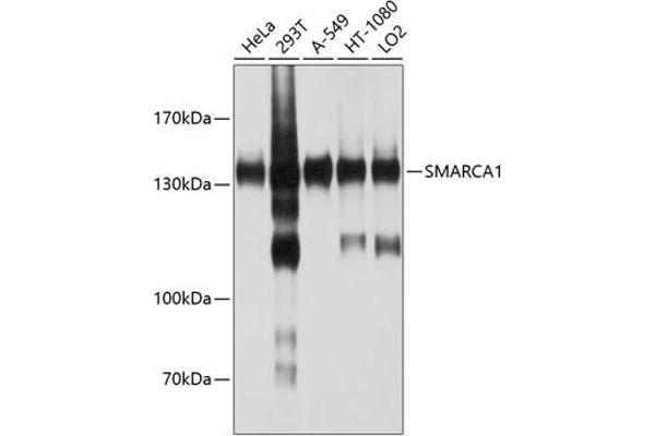 SMARCA1 antibody  (AA 1-200)