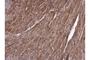 IHC-P Image ALDH7A1 antibody detects ALDH7A1 protein at cytoplasm in mouse heart by immunohistochemical analysis.