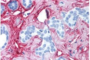 Human Breast (formalin-fixed, paraffin-embedded) stained with COL6A1 antibody ABIN214581 at 2. (COL6 antibody)