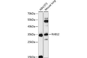 Western blot analysis of extracts of various cell lines, using R antibody (ABIN7269796) at 1:3000 dilution. (RAB12 antibody  (AA 1-70))