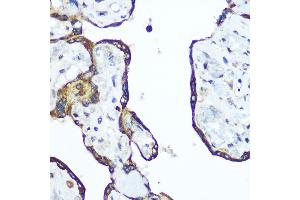 Immunohistochemistry of paraffin-embedded human placenta using RhoA Rabbit pAb (ABIN6134426, ABIN6146932, ABIN6146933 and ABIN6218128) at dilution of 1:100 (40x lens). (RHOA antibody  (C-Term))