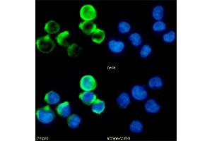 Immunofluorescence staining of fixed Jurkat cells with anti-4-1BB antibody 4B4-1-1. (Recombinant CD137 antibody)