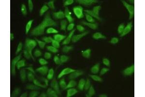 Detection of ICAM1 in Hela cells using Polyclonal Antibody to Intercellular Adhesion Molecule 1 (ICAM1) (ICAM1 antibody  (AA 102-306))