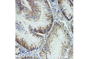 Anti-FER antibody, IHC(P) IHC(P): Rat Intestine Tissue (FER antibody  (Middle Region))