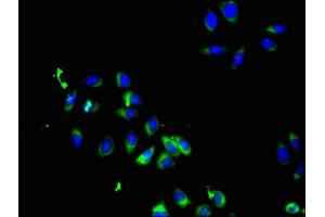 Immunofluorescent analysis of A549 cells using ABIN7169898 at dilution of 1:100 and Alexa Fluor 488-congugated AffiniPure Goat Anti-Rabbit IgG(H+L) (SMO antibody  (AA 28-233))