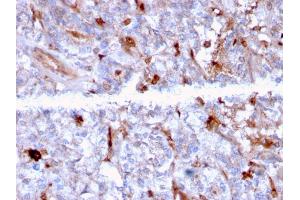 Formalin-fixed, paraffin-embedded human Kidney stained with C1QA Mouse Monoclonal Antibody (C1QA/2956).