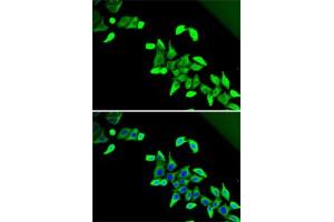 Immunofluorescence analysis of U2OS cells using CDK antibody (ABIN6131010, ABIN6138333, ABIN6138334 and ABIN6221451). (CDKAL1 antibody  (AA 1-230))