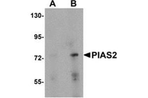 Western blot analysis of PIAS2 in rat brain tissue lysate with PIAS2 antibody at (A) 1 and (B) 2 μg/ml.