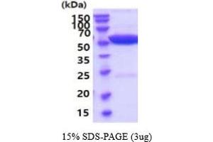 SDS-PAGE (SDS) image for Alanine Aminotransferase (ALT) (AA 1-496) (Active) protein (His tag) (ABIN6387974) (ALT Protein (AA 1-496) (His tag))