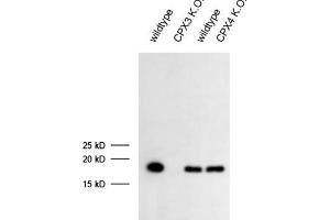 dilution: 1 : 1000 (ECL), sample: mouse retina extract (CPLX3 antibody)