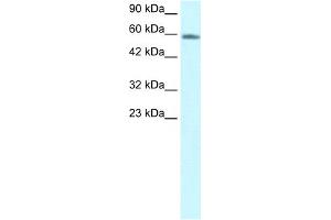 WB Suggested Anti-CHES1 Antibody Titration:  1. (FOXN3 antibody  (C-Term))