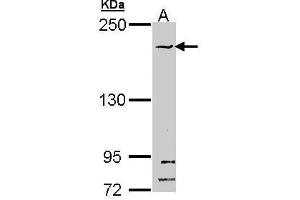 WB Image Sample (30 ug of whole cell lysate) A: Hela 5% SDS PAGE antibody diluted at 1:1000 (SMC1B antibody  (N-Term))